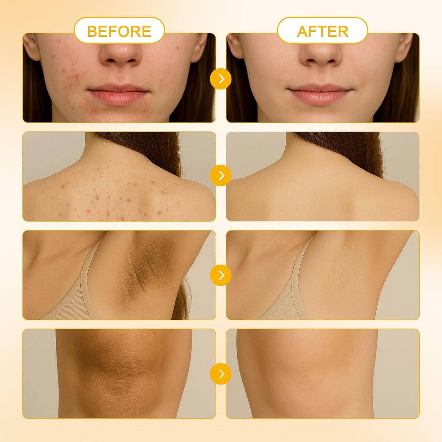 Turmeric Soap for Spot Removal - Organic Honey Lemon Turmeric Kojic Soap Bar for Face and Body, Daily Skin Care for Even Tone and Deep Cleansing Moisturization (3 Pieces)