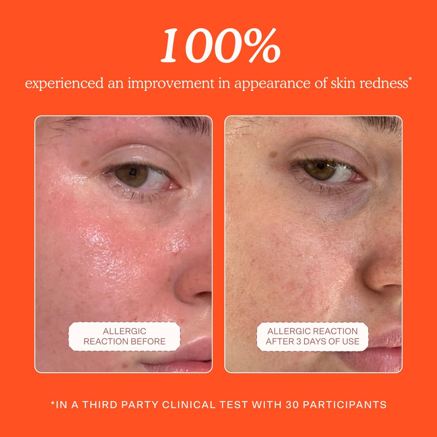 SOS Daily Rescue Facial Spray - Hypochlorous Acid Spray to Help Reduce Redness, Calm Irritation + Alleviate Flare-Ups - Soothing + Purifying Face Toner - Everyday Skin Care Essential (4 Oz)