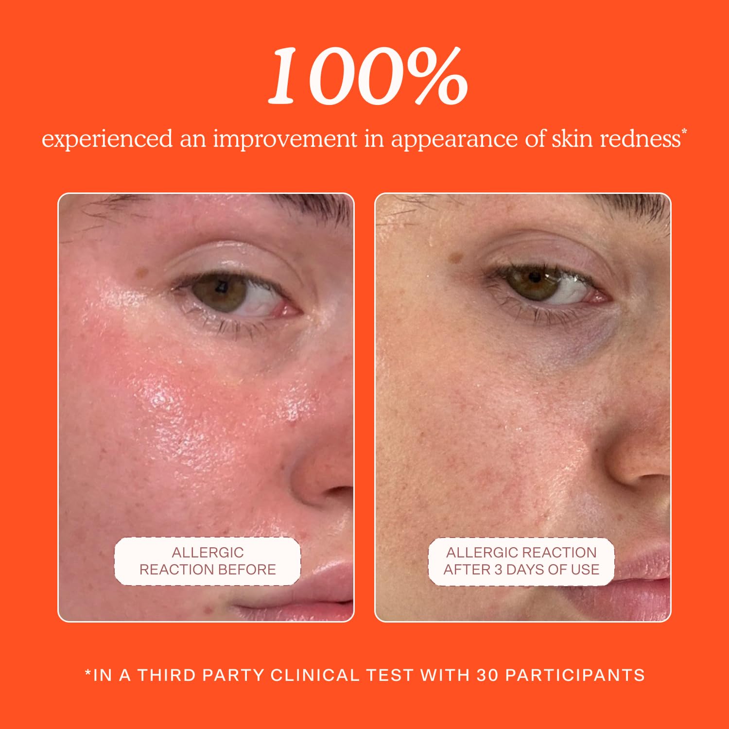SOS Daily Rescue Facial Spray - Hypochlorous Acid Spray to Help Reduce Redness, Calm Irritation + Alleviate Flare-Ups - Soothing + Purifying Face Toner - Everyday Skin Care Essential (4 Oz)