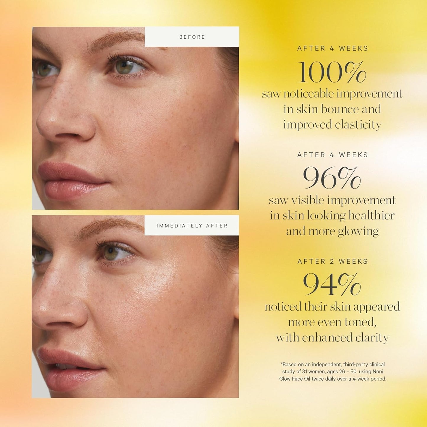 Revitalize Your Skin with Noni Glow Hydrating Face Oil - Organic Rosehip Infusion for Radiant Beauty, 0.34 Fl Oz