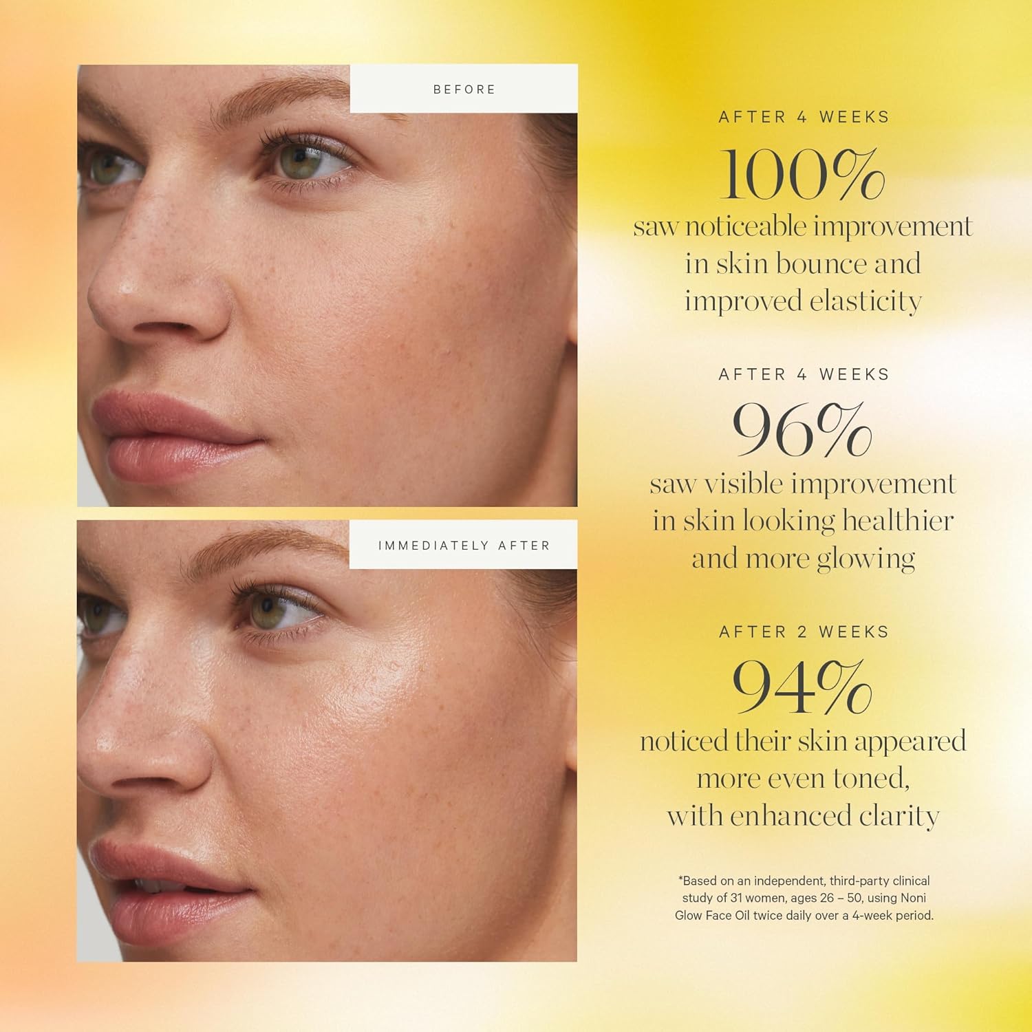 Revitalize Your Skin with Noni Glow Hydrating Face Oil - Organic Rosehip Infusion for Radiant Beauty, 0.34 Fl Oz